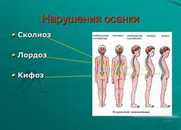 Правильная осанка - Бобкова_0.jpg